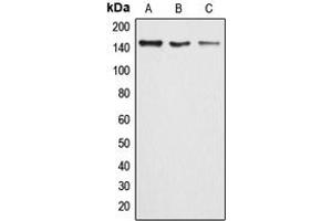 Western blot analysis of ARID4B expression in HeLa (A), MCF7 (B), rat lung (C) whole cell lysates. (BRCAA1 anticorps  (Center))