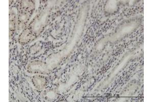 Image no. 1 for anti-Distal-Less Homeobox Protein 2 (DLX2) (AA 1-110) antibody (ABIN598648) (DLX2 anticorps  (AA 1-110))