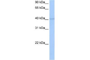 WB Suggested Anti-RBM4 Antibody Titration:  0. (RBM4 anticorps  (C-Term))