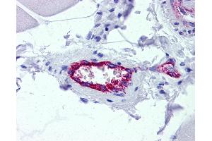 Anti-AAAS / Adracalin antibody IHC of human skeletal muscle, vessel.
