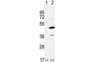Western blot analysis of IRAK4 antibody and 293 cell lysate either nontransfected (Lane 1) or transiently transfected (2) with the IRAK4 gene. (IRAK4 anticorps  (AA 5-36))