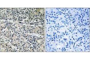 Immunohistochemistry analysis of paraffin-embedded human prostate carcinoma tissue, using MP68 Antibody. (C14orf2 anticorps  (AA 9-58))
