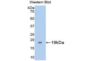 Western Blotting (WB) image for anti-Caspase 2, Apoptosis-Related Cysteine Peptidase (CASP2) (AA 170-333) antibody (ABIN3208971) (Caspase 2 anticorps  (AA 170-333))