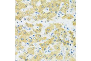 Immunohistochemistry of paraffin-embedded human liver using SLC37 antibody (ABIN7270453) at dilution of 1:100 (40x lens).