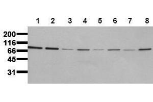 Western Blotting (WB) image for anti-Insulin Receptor (INSR) (Beta Chain) antibody (ABIN126821) (Insulin Receptor anticorps  (Beta Chain))