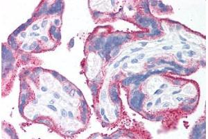 Human Placenta (formalin-fixed, paraffin-embedded) stained with CD59 antibody ABIN214204 at 20 ug/ml followed by biotinylated anti-mouse IgG secondary antibody ABIN481714, alkaline phosphatase-streptavidin and chromogen. (CD59 anticorps)