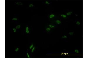 Immunofluorescence of monoclonal antibody to CCNL1 on HeLa cell. (Cyclin L1 anticorps  (AA 1-172))
