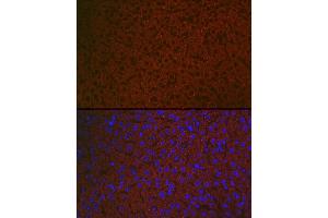 anti-Retinoic Acid Receptor Responder (Tazarotene Induced) 2 (RARRES2) (AA 17-163) antibody