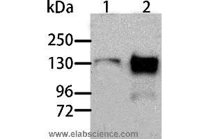 Western blot analysis of Human liver cancer and normal liver tissue, using AOX1 Polyclonal Antibody at dilution of 1:1000 (AOX1 anticorps)