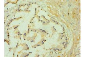 Immunohistochemistry of paraffin-embedded human prostate tissue using ABIN7157843 at dilution of 1:100