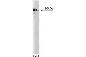 Western blot analysis of NMDAR2B on a rat cerebrum lysate.