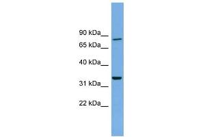 WB Suggested Anti-DDHD2 Antibody Titration: 0. (DDHD2 anticorps  (N-Term))