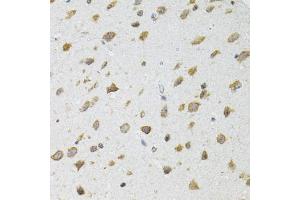Immunohistochemistry of paraffin-embedded mouse brain using SIRT3 antibody (ABIN5973348) at dilution of 1/100 (40x lens). (SIRT3 anticorps)