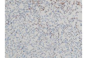 ABIN6267443 at 1/100 staining mouse lung tissue sections by IHC-P.