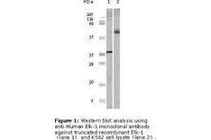 Image no. 1 for anti-ELK1, Member of ETS Oncogene Family (ELK1) antibody (ABIN207629) (ELK1 anticorps)