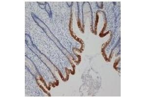 Staining of paraffin embedded human appendix with mouse anti human cytokeratin 19 (ABIN114797). (Cytokeratin 19 anticorps)
