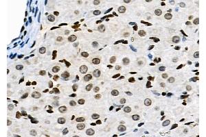 ABIN6263641 and ABIN6278983 at 1/100 staining Rat ovarian tissue by IHC-P. (NKAP anticorps  (N-Term))