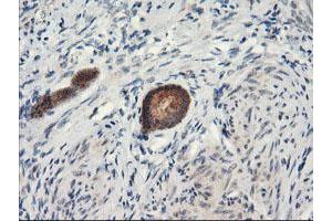 Image no. 2 for anti-Proteasome Subunit alpha 4 (PSMA4) antibody (ABIN1500457)