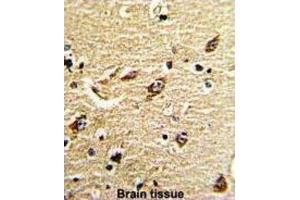 Immunohistochemistry (IHC) image for anti-Mitochondrially Encoded NADH Dehydrogenase 5 (MT-ND5) antibody (ABIN3002895)