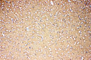 Anti-EAAT1 antibody, IHC(P) IHC(P): Rat Brain Tissue