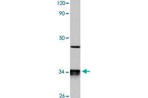 Western blot analysis of HeLa cell lysate with CYB5R3 polyclonal antibody  at 1:500 dilution. (CYB5R3 anticorps)