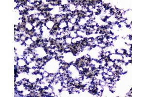 IHC analysis of CIC using anti-CIC antibody (ABIN6719536). (CIC anticorps  (AA 1433-1527))
