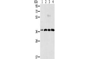Gel: 12 % SDS-PAGE, Lysate: 40 μg, Lane 1-4: Hela cells, Jurkat cells, 293T cells, 231 cells, Primary antibody: ABIN7193012(VEGFA Antibody) at dilution 1/300, Secondary antibody: Goat anti rabbit IgG at 1/8000 dilution, Exposure time: 50 seconds (VEGFA anticorps)