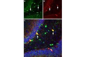 Multiplex staining of ASIC1 and parvalbumin in rat hippocampus - Immunohistochemical staining of immersion-fixed, free floating rat brain frozen sections using Guinea pig Anti-ASIC1 Antibody (ABIN7042914, ABIN7045410 and ABIN7045411), (1:300). (ASIC1 anticorps  (C-Term, Intracellular))