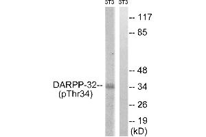 Immunohistochemistry analysis of paraffin-embedded human brain tissue using DARPP-32 (Phospho-Thr34) antibody. (DARPP32 anticorps  (pThr34))