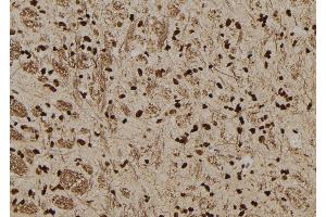 ABIN6277578 at 1/100 staining Rat brain tissue by IHC-P. (SERPINB3 anticorps  (C-Term))