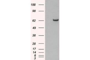 Western Blotting (WB) image for anti-Growth Factor Receptor-Bound Protein 7 (GRB7) (N-Term) antibody (ABIN2465793) (GRB7 anticorps  (N-Term))