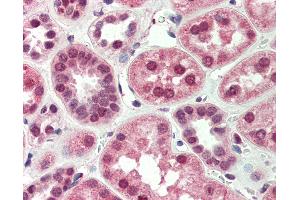 Anti-BNIP3L antibody IHC of human kidney. (BNIP3L/NIX anticorps  (AA 77-92))