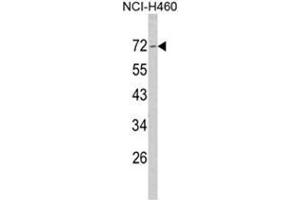 Western blot analysis of Merlin Antibody (N-term) in NCI-H460 cell line lysates (35ug/lane). (Merlin anticorps  (N-Term))