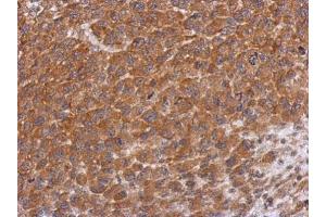 IHC-P Image Immunohistochemical analysis of paraffin-embedded H1299 xenograft, using Dysbindin, antibody at 1:500 dilution. (DTNBP1 anticorps)