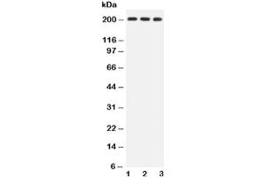 Western blot testing of BRCA1 antibody and Lane 1:  HeLa (BRCA1 anticorps  (AA 1661-1863))