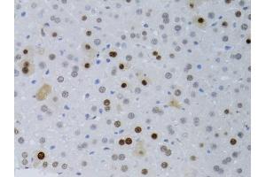Immunohistochemistry of paraffin-embedded mouse liver using PCNA antibody (ABIN1874056) at dilution of 1:100 (40x lens). (PCNA anticorps)