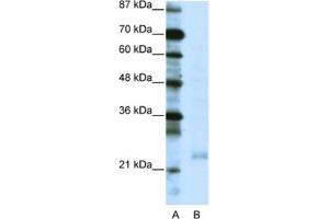 Western Blotting (WB) image for anti-TAF10 RNA Polymerase II, TATA Box Binding Protein (TBP)-Associated Factor, 30kDa (TAF10) antibody (ABIN2460218) (TAF10 anticorps)