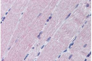 Human Skeletal Muscle (formalin-fixed, paraffin-embedded) stained with MAP2K6 antibody ABIN290187 at 1:50 followed by biotinylated goat anti-rabbit IgG secondary antibody ABIN481713, alkaline phosphatase-streptavidin and chromogen. (MAP2K6 anticorps  (N-Term))