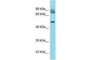 Western Blotting (WB) image for anti-Tripartite Motif Containing 64 (TRIM64) (N-Term) antibody (ABIN2791962) (TRIM64 anticorps  (N-Term))