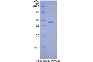SDS-PAGE analysis of Human Glypican 4 Protein. (GPC4 Protéine)