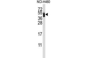 Western Blotting (WB) image for anti-Coxsackie Virus and Adenovirus Receptor (CXADR) antibody (ABIN3001668)