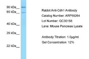 Western Blotting (WB) image for anti-Cadherin 1, Type 1, E-Cadherin (Epithelial) (CDH1) (C-Term) antibody (ABIN2787998)