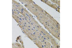Immunohistochemistry of paraffin-embedded rat heart using ALDH9A1 antibody. (ALDH9A1 anticorps)