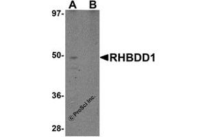 Western Blotting (WB) image for anti-Rhomboid Domain Containing 1 (RHBDD1) (C-Term) antibody (ABIN1030618) (RHBDD1 anticorps  (C-Term))
