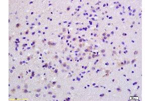 Formalin-fixed and paraffin embedded rat brain labeled with Anti-S100B Polyclonal Antibody, Unconjugated  at 1:200 followed by conjugation to the secondary antibody and DAB staining.