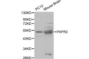 Western blot analysis of various cell lines, using PARK2 antibody. (Parkin anticorps)