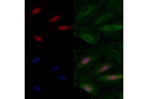 ABIN6257236 and ABIN6275800 staining  cells by IF/ICC. (GATA6 anticorps  (Internal Region))