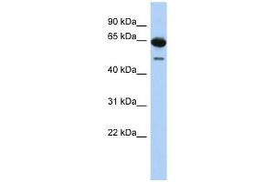 DAZ1 antibody used at 1 ug/ml to detect target protein. (DAZ1 anticorps  (N-Term))