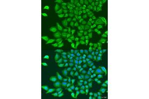 Immunofluorescence analysis of U2OS cells using TUBGCP3 antibody.