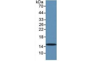 WB of Protein Standard: different control antibodies  against Highly purified E. (TGFB1 Kit ELISA)